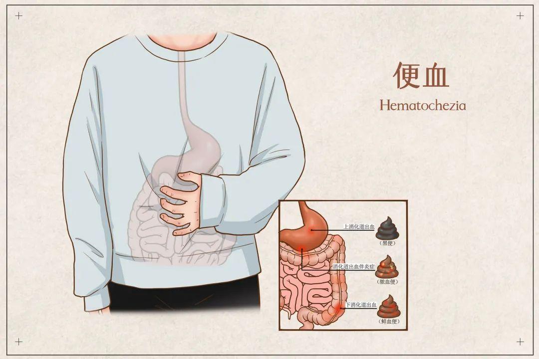 最新肝功能分级标准及其应用解析